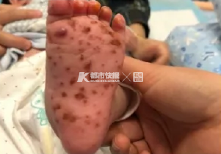 东莞家长注意了！2个月大的婴儿因家人这个动作，感染了致命病毒！​